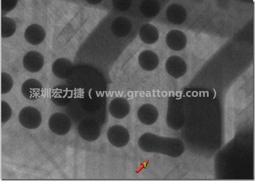 BGA因為焊墊變小，造成錫膏過多而最終形成焊接短路的結果。